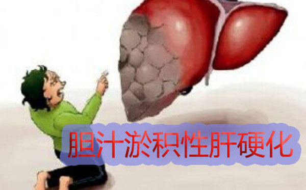 郑州市哪家肝病医院是治疗肝硬化效果好